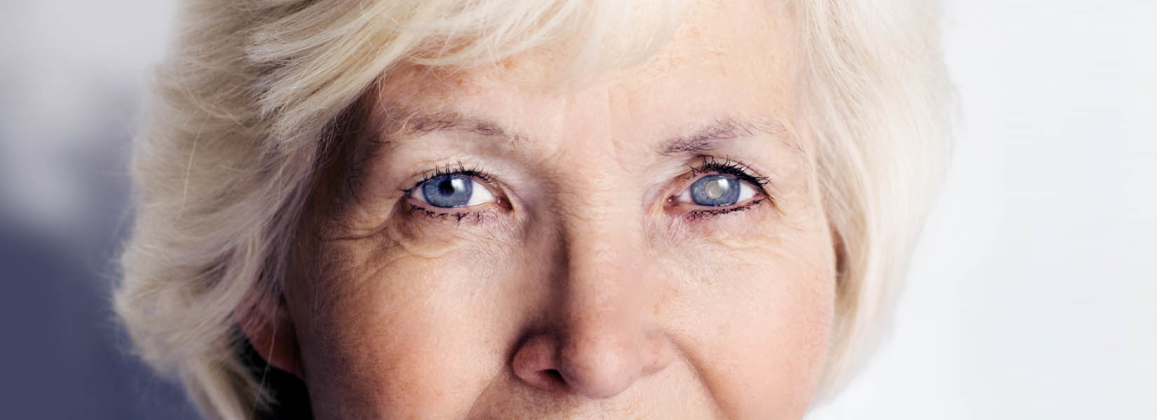 Cataract Surgery in Squirrel Hill South